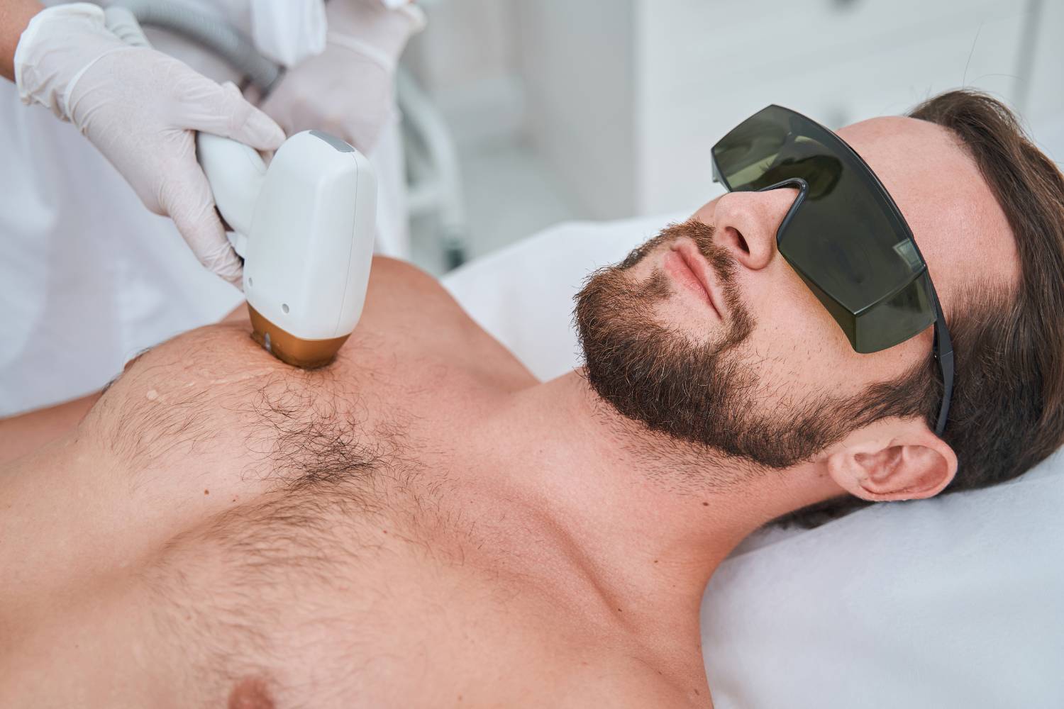 Laser Hair Removal For Men: What To Expect And Helpful Insights