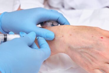 Hand Rejuvenation for Dry Skin Relief and Damaged Skin Repair