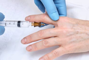 Affordable Hand Rejuvenation Treatments for Smooth, Youthful-Looking Skin