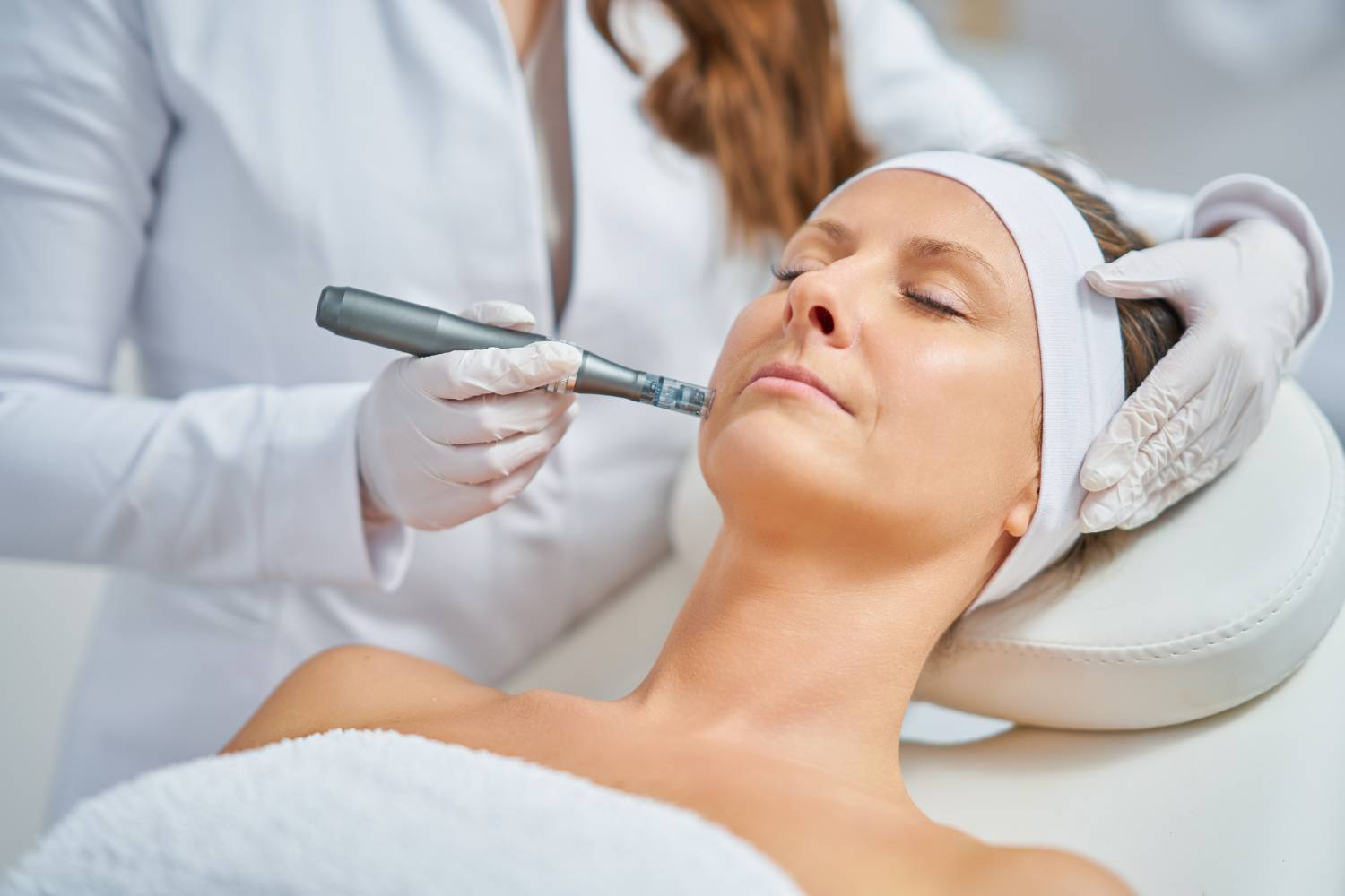 The Power of Skin Needling for Collagen Boosting and Scar Reduction