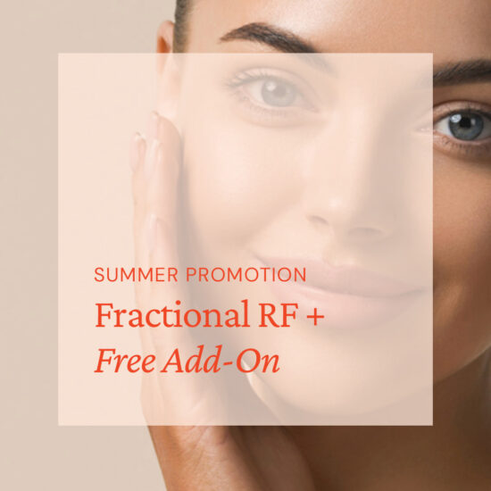 Fractional RF + Free Add-On