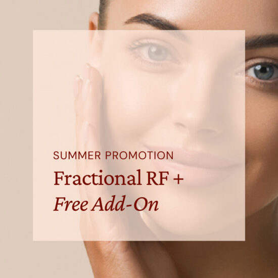 Fractional RF + Free Add-On