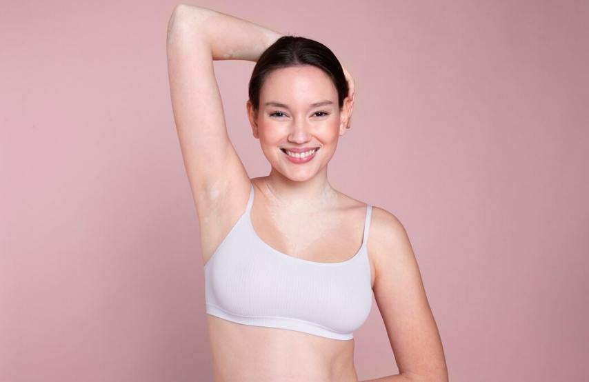Botox for Underarm Sweating: Safe Injectable Treatment Guide