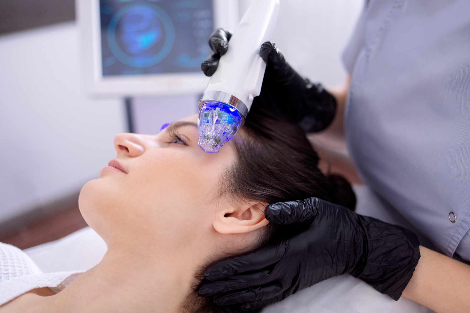 RF Microneedling: What Really Happens to Your Skin